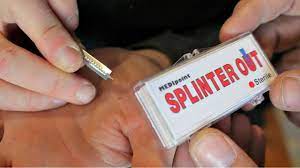 Simple Trick Removes Splinter Easier Youtube
