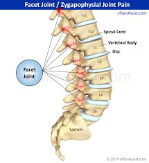 Your physiotherapist will quickly detect which facet joint is locked. Facet Joint Or Zygapophysial Joint Pain Treatment Causes Symptoms