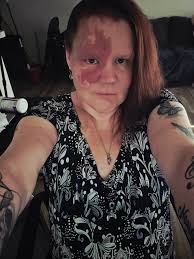 Please pray for Kathy to have a breakthrough with Scott's situation. He is  improving but needs to move to another hospital before something tragic  happens at this careless place. Pray for protection