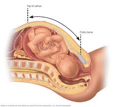 Many cases are diagnosed at an early stage because abnormal vaginal bleeding often develops at an early stage of. Fetal Macrosomia Symptoms And Causes Mayo Clinic