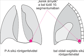 Bios = élet és opsy = megjelenés szavakból) egy orvosi eljárás, melynek során vizsgálat céljából a testből sejteket vagy szöveteket távolítanak el. Sebeszet Digitalis Tankonyvtar