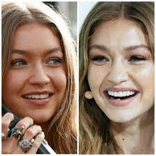 Big sunglasses sunnies bella hadid gigi hadid lady luxury black shades shady lady celeb style fashion black. Supermodel Gigi Hadid Takes Special Care Of Her Teeth Gmspors