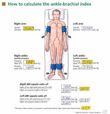 using the ankle brachial index to diagnose peripheral artery