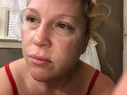 Morning skin care and routine