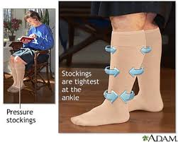 Compression Stockings Information Mount Sinai New York