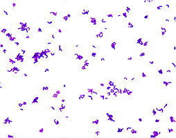 Image result for Corynebacterium