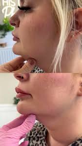 Beauty & Aesthetics By Bonnie