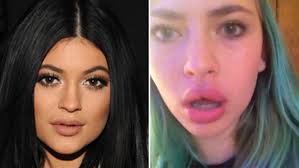 Kylie jenner lip kit like gloss matte liquid lipsticks sets with matte lipgloss & lipliner kylie jenner lipstick kylie lip kit (posie k) 3.1 out of 5 stars. Kylie Jenner Lip Challenge Is Dangerous Experts Say Cbs New York