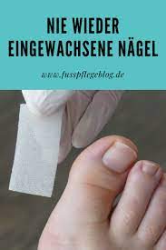 nagel tamponieren mit ligasano fusspflegeblog eingewachsener nagel zehennagel eingewachsener zehennagel