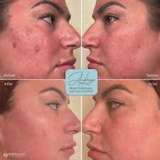 Dermalase Medical Spa