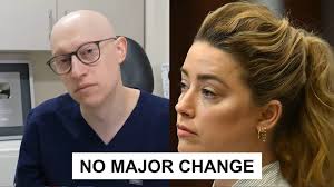 There's a theory that Amber Heard's injuries from allegedly Johnny Depp's  attacks were from Botox injections. In this video, we investigate if these  theories have any merit to them from a more ...