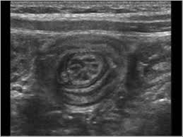 Pin On Ultrasound
