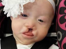 Fundraiser by Rachelle Parke : Makenzie Piatt's Medical