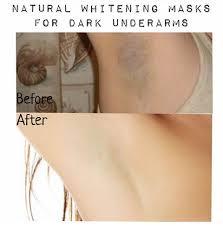 Having underarms hair is also one of the main beauty issues. Welcome To Afroz Hair Naturally Get Rid Of Dark Underarm Armpit