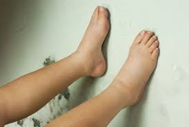 Risau kalau lambat sembuh dan kaki akan terus membengkak? Tip Kurangkan Kaki Bengkak Ketika Hamil June 2021 Kelabmama Malaysia