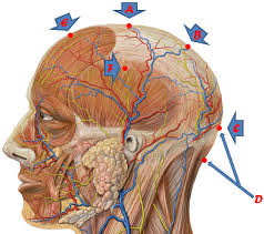 Image result for bekam kepala