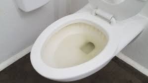 6 hidrofob kısım yağa tutunur, hidrofil kısım ise suya tutunur ve bu şekilde yağ yüzeyden el ve yüzde kullanıldığı taktirde cilt de tahrişe sebep olurlar. Camasir Sodasi Nedir Ve Ne Ise Yarar Uzmanlar Diyor Ki