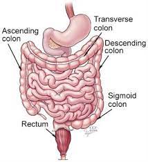 What are bowel cancer symptoms? Colorectal Colon Cancer Symptoms Diagnosis Treatments