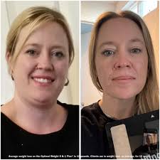 Christmas 2017. I was just telling my husband this morning that I literally  thought that was the real shape of my face. I didn't realize that I was so  badly inflamed. I