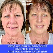 🤢 I'm so sorry for the gross pictures but I wanted to show you how  incredible our skin care line is. On the left you will see what my skin  normally looks