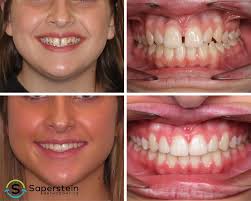 Saperstein Orthodontics