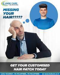 Hair Patch Service Hair Replacement Hair Clinic Best Hair Transplant