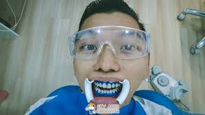 I recommend the teeth whitening kit as well! Laser Teeth Whitening M Dental Clinic Damansara Utama