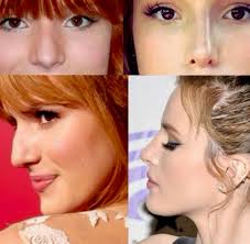 Pin By Jamie Dingianni On Before And After Rhinoplasty Nose Jobs Big Nose Beauty Nose Job