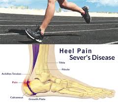 Pin On Sports Injury Rehabilitation Fitness Training Diet Nutrition