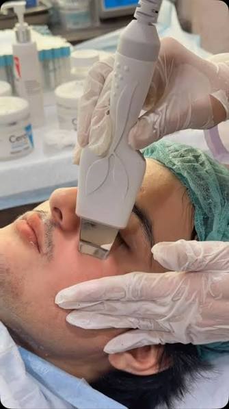 Ultrasonic facial treatment