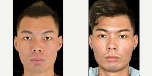 RealSelf: Denise Wong, MD, FACS