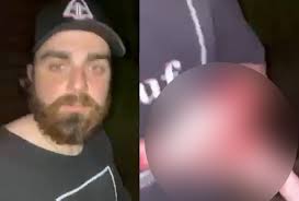 Lacrosse Community Says Pro Lax Bro Has Part Of His Finger Bitten Off By  Another Lax Bro In A Hotel Fight