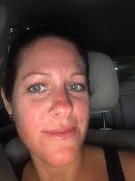 A better view of the lip. Rlc. Oconee 'Mendenhall'