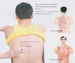 Gua Sha For Diabetes Over Pancreas Clip Image00223 Jpg 572 480 Gua Sha Gua Sha Massage Complementary Therapy
