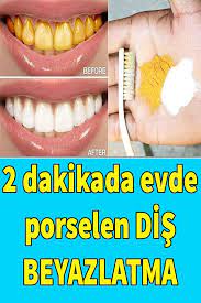2 Dakikada Evde Porselen Dis Beyazlatma Sararmis Disler Nasil Beyazlar Agiz Ve Dis Sagligi Dogal Dis Beyazlatma Dis Dogal Guzellik Ipuclari