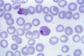 It feels like the flu a doctor has to look at someone's blood under a microscope to tell if they have it. Friday Fun Facts 5 25 2012 Plasmodium Malaria Fun Science
