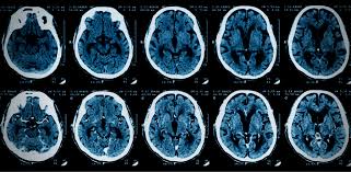 China lockdowns behind iodinated contrast media shortage | Australian  Medical Association