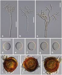Image result for peronospora grapevine