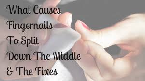 What Causes Fingernails To Split Down The Middle The Fixes Discover Why Your Nails May Be Horizontally Or Ve Split Nails Split Nail Repair Split Toenail