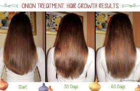 How onion juice helps in the hair fall and hair loss? Onion Juice For Hair Growth Gives Unlimited Benefits For Our Hair