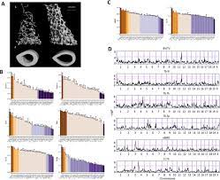 Maybe you would like to learn more about one of these? A Genome Wide Association Study In Mice Reveals A Role For Rhbdf2 In Skeletal Homeostasis Scientific Reports