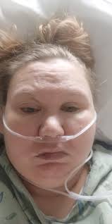 Is chest pain after eating gas?