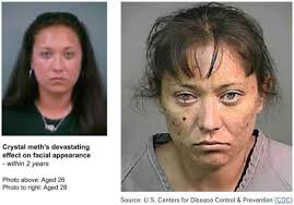 How to explain addiction recovery to your child. Before And After Meth Pictures The Scary Truth About Meth Addiction