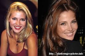 Elsa pataky plastic surgery before and after photos, elsa pataky measurements, bra size, elsa pataky breast implants, cosmetics surgery, . Which Female Celeb Has Best Realistic Plastic Surgery Page 3 Lipstick Alley