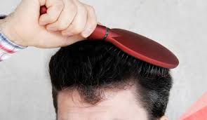 More from Pharmacist Darryl Segal about Hair Loss