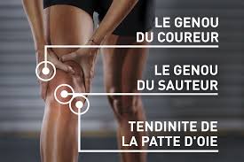 Échauffement complet avant un footing en 3 minutes. De Quelle Douleur Au Genou Souffrez Vous Myfitsession