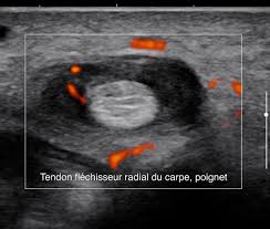 Echographie obstétricale 4d à paris 19. Echographie Doppler Examen D Imagerie Medicale A Paris