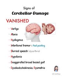 Image result for Cerebellar Function Test