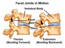 In the case of a locked facet joint, physiotherapy will relieve the majority of pain with complete relief, improving immediately post unlocking. Facet Block Injections In Fort Lauderdale Fl Jonathan Aarons Md