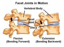 Specific treatment will vary depending upon your particular facet joint arthropathy. Facet Block Injections In Fort Lauderdale Fl Jonathan Aarons Md
